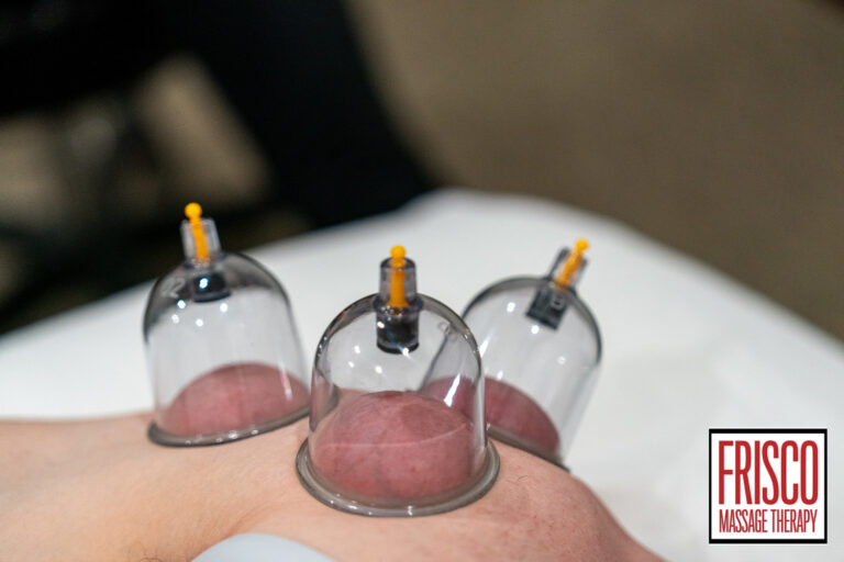 Three glass skin cupping therapy cups placed on a person's back, with the Frisco Massage Therapy logo in the bottom right corner.